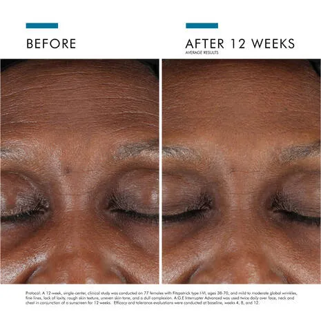 SkinCeuticals® A.G.E. Interrupter ADVANCED